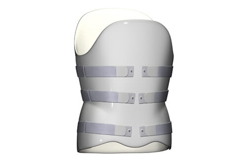 Spinal Orthoses