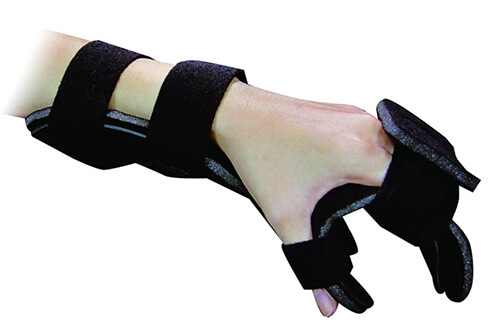 Upper Limb Orthoses